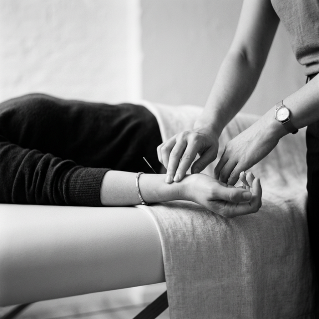 Close-up of acupuncture needle on wrist during pulse diagnosis